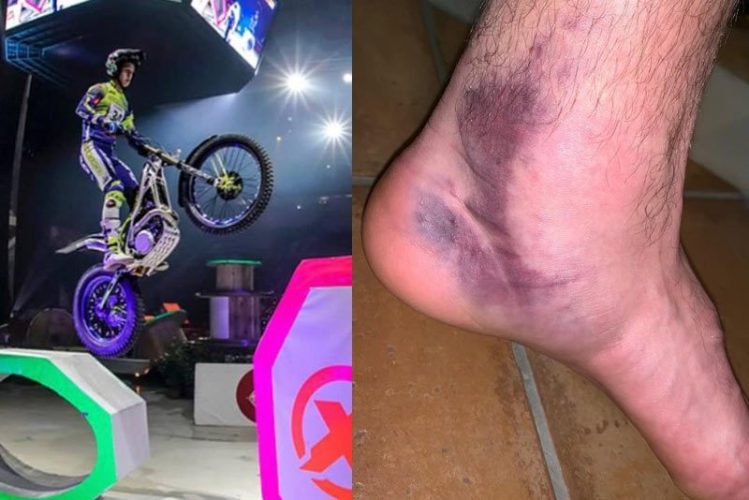Miquel Gelabert lesionado, no estará en Budapest